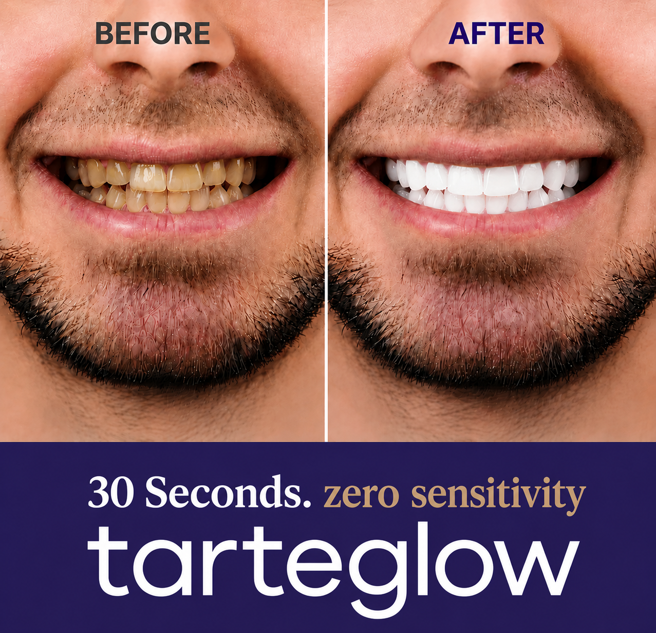 Tarteglow Purple Mouthwash - Sachets 20 Pack
