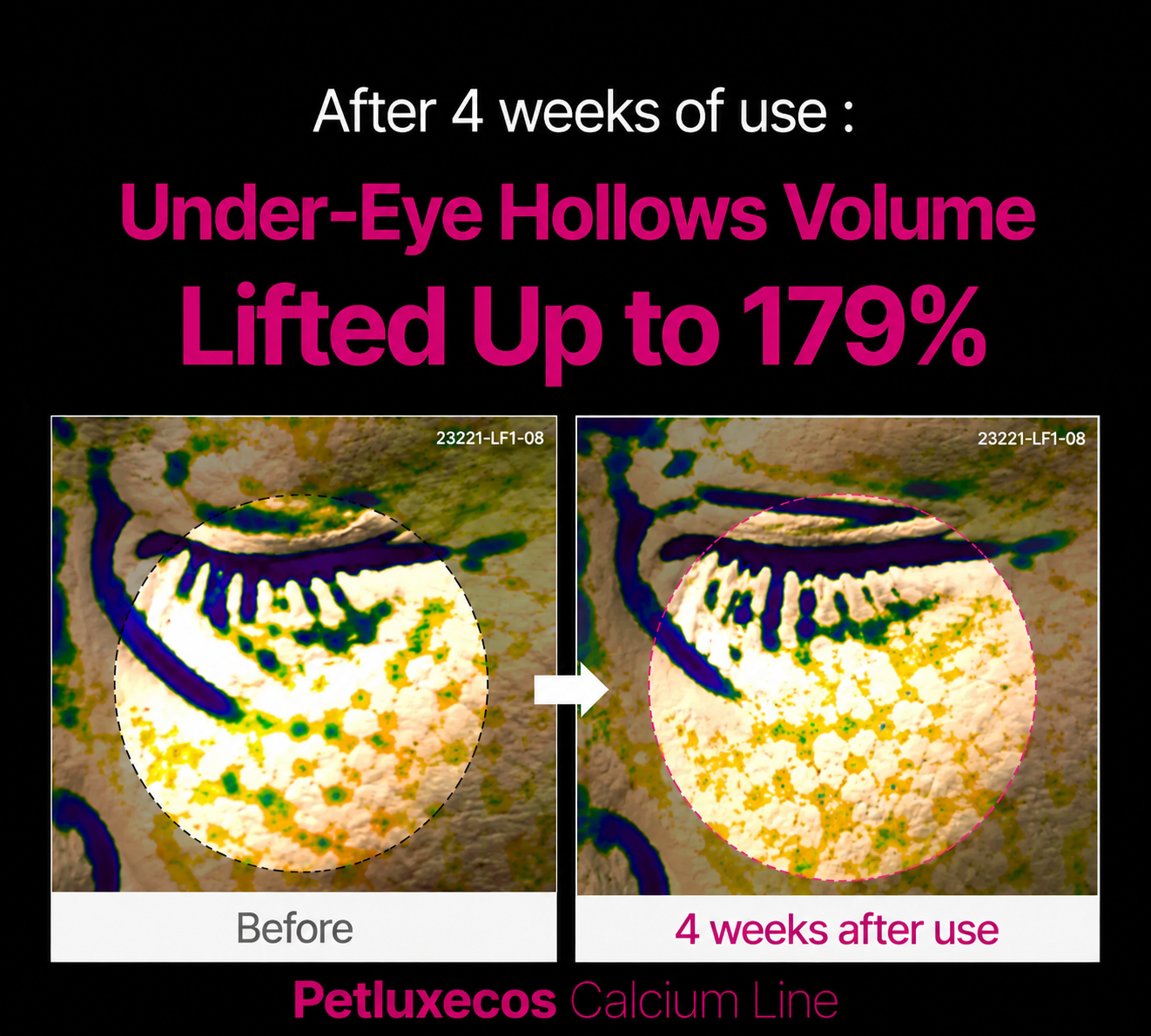 🔥LAST DAY 50% OFF!!tarteglow Korean Calcium Dark Spot Eye Cream
